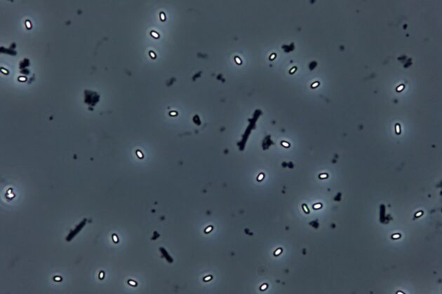 Spores are a great challenge in food products with medium and long shelf life.